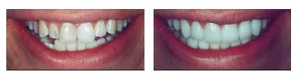 Cosmetic Dentistry 