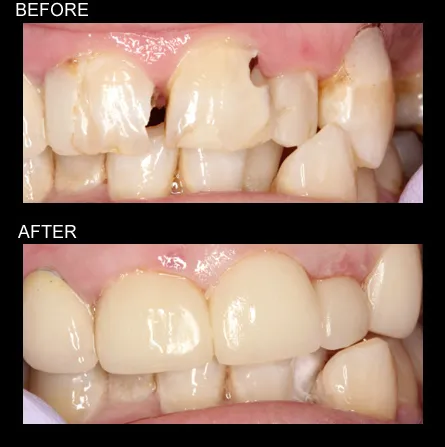 Case04