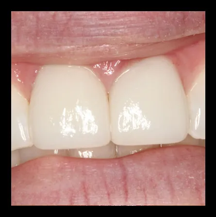 Case05